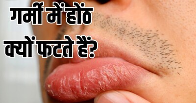 उन्हाळ्यात ओठ फाटतात? ही आहेत 5 कारणे आणि मऊ ओठांसाठी सोपे उपाय!