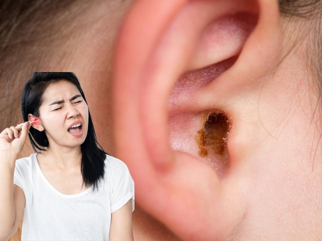 Yellow or watery liquid coming out of ear? Don't ignore it even by mistake, otherwise...