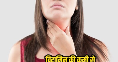 Vitamin D की कमी Thyroid से जुड़ी.
