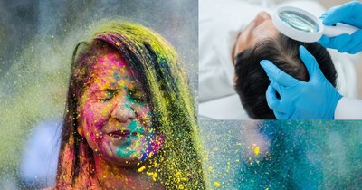 Holi Colors' Hidden Danger: Dermatologist Reveals Hair Damage & Safe Removal Tips