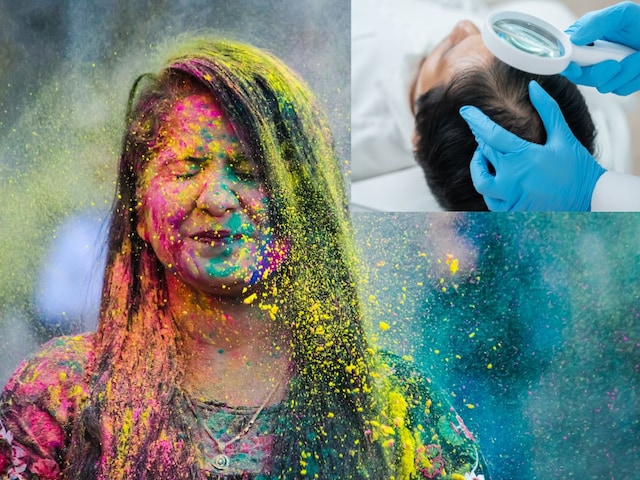 হোলি খেলে চুল কেন নষ্ট হয়? প্রতিরোধের পদ্ধতি জানালেন চর্মরোগ বিশেষজ্ঞ ডা