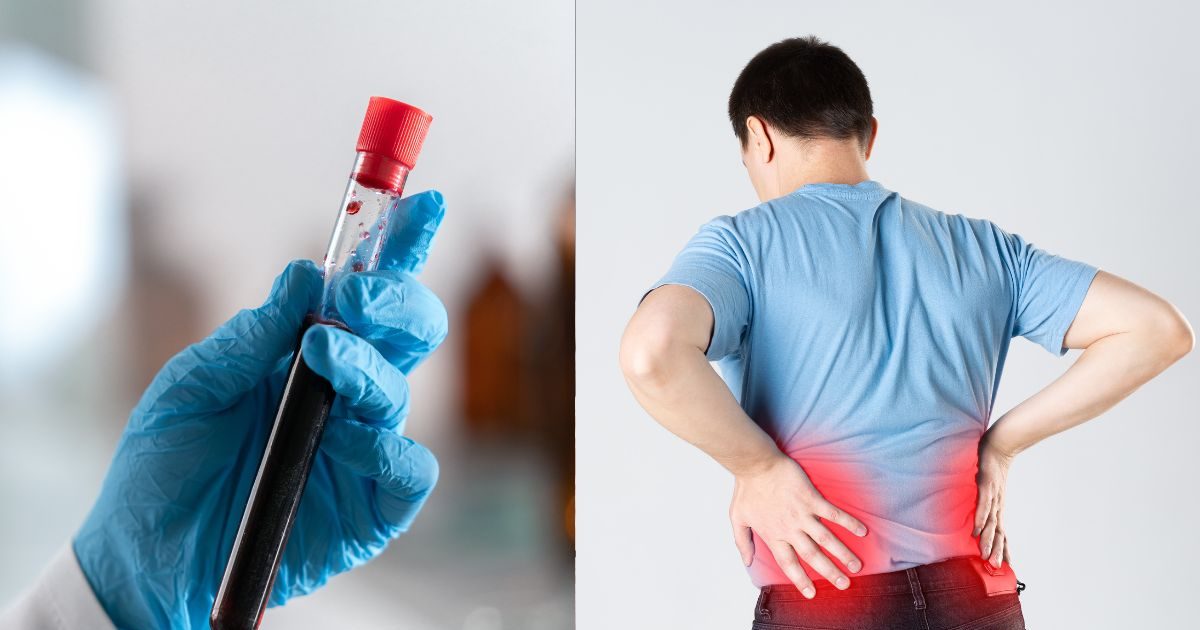 क्या ब्लड टेस्ट से भी डिटेक्ट होता है किडनी स्टोन? क्यों दी जाती है अल्ट्रासाउंड की सलाह