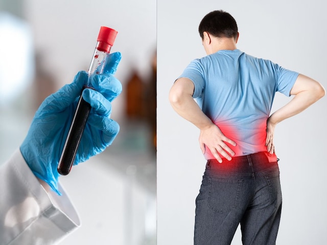 রক্ত পরীক্ষার মাধ্যমে কিডনিতে পাথর শনাক্ত করা যায়? বিশেষজ্ঞের কাছ থেকে জেনে নিন