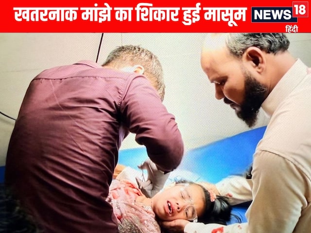 खतरनाक चाइनीज मांझे का शिकार हुई लखनऊ की 6 साल की अबीहा फातिमा, लगे टांके