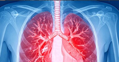 35-40 की उम्र के बाद सभी को अपने फेफड़ों की जांच जरूर करवानी चाहिए.