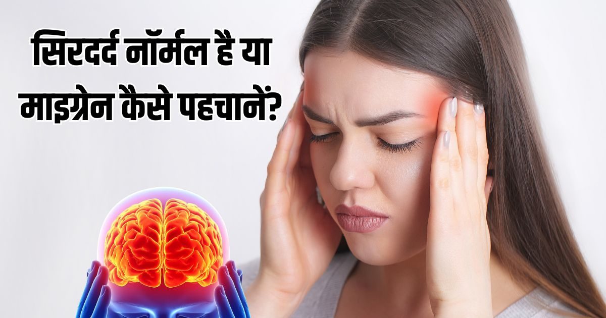 सिरदर्द नॉर्मल है या माइग्रेन कैसे पहचानें? डायग्नोसिस के लिए फॉलो करें ये फॉर्मूला