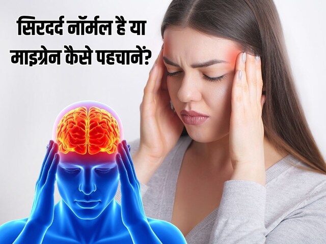 सिरदर्द नॉर्मल है या माइग्रेन कैसे पहचानें? फॉलो करें ये डायग्नोसिस फॉर्मूला