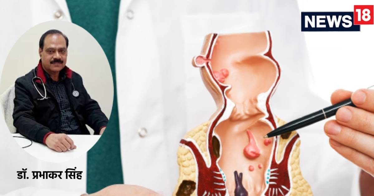 लोको पायलट पाइल्स सर्जरी मामला: बवासीर के ऑपरेशन के बाद कितने दिन में रिकवर होता है मरीज?