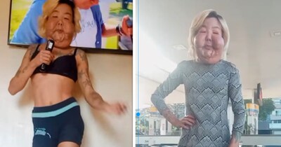 सर्जन्स ने सिलिकॉन की जगह मिनरल ऑइल का इस्तेमाल कर दिया (इमेज- फाइल फोटो) 