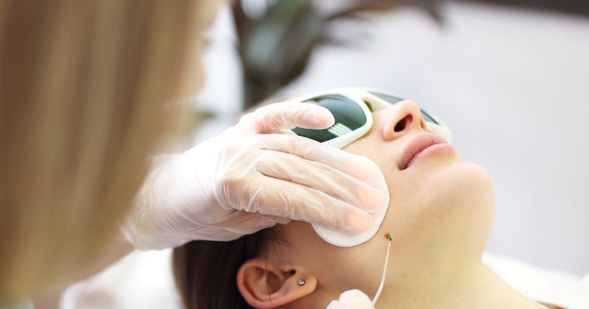 शरीर पर क्यों निकल आते हैं मस्से? क्या है सबसे बड़ी वजह, मस्सों से कैसे मिलेगा छुटकारा, एक