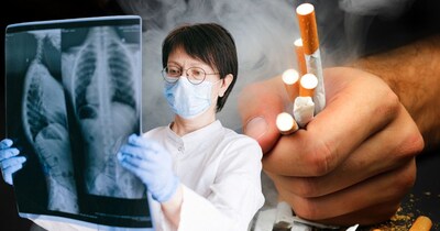 स्मोकिंग से कई घातक बीमारियां पैदा हो सकती हैं.