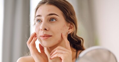 गर्मियों में स्किन को हेल्दी रखने के लिए पसीना और धूप से बचाना जरूरी होता है.