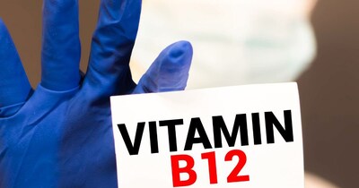 विटामिन B12 की कमी से बालों की कई समस्याएं पैदा हो सकती हैं.