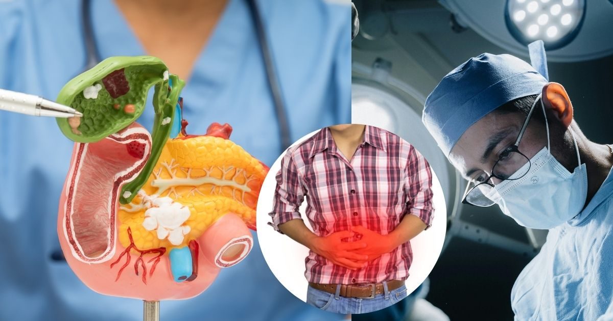 पित्त की पथरी का दर्द कहां होता है? गालब्लैडर स्टोन के इन लक्षणों को न करें नजरअंदाज