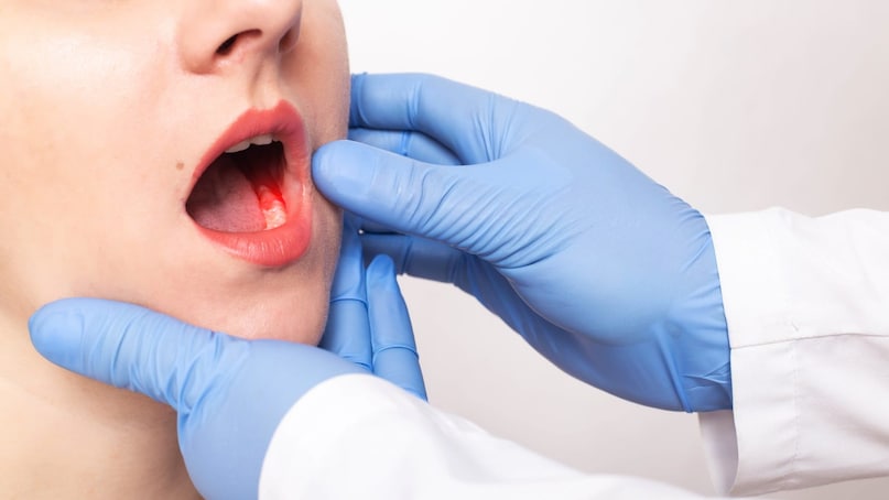 These Everyday Symptoms Could Be Early Signs Of Oral Cancer