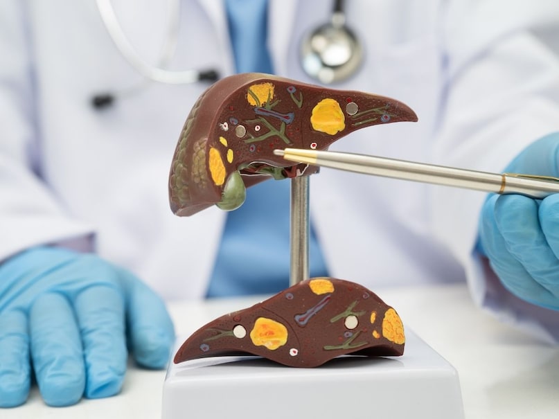 पित्ताशय लिवर के ठीक पीछे थैलीनुमा एक छोटा सा अंग है. इसमें पथरी की समस्या बहुत ही कॉमन होती जा रही है. लेकिन पित्त की थैली में पथरी का पता उस समय तक नहीं लग पाता है, जब तक ये बाइल डक्ट में रूकावट पैदा नहीं करते हैं. पित्ताशय लिवर के ठीक पीछे थैलीनुमा एक छोटा सा अंग है. इसमें पथरी की समस्या बहुत ही कॉमन होती जा रही है. लेकिन पित्त की थैली में पथरी का पता उस समय तक नहीं लग पाता है, जब तक ये बाइल डक्ट में रूकावट पैदा नहीं करते हैं.