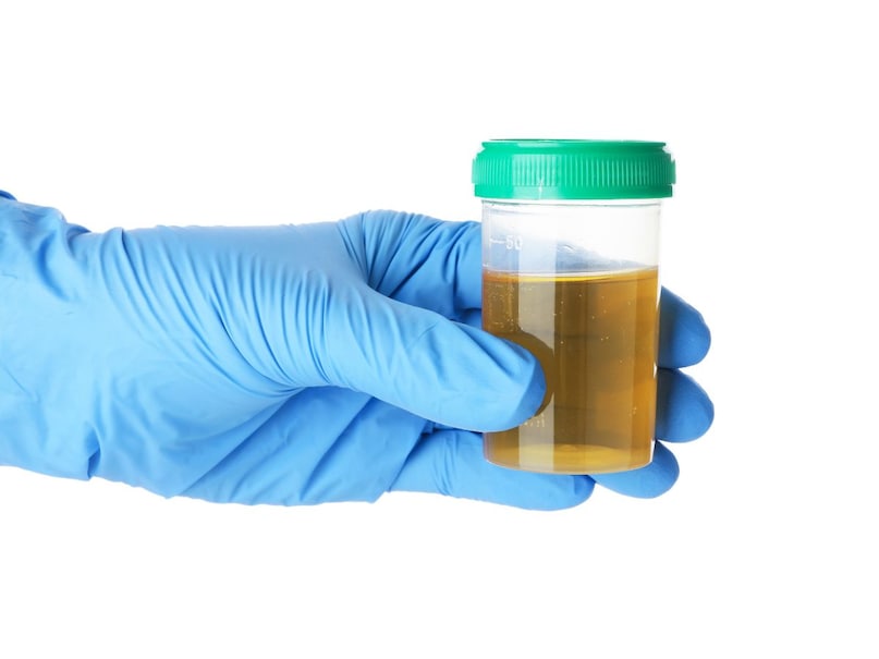 दर्द के अलावा गालब्लैडर स्टोन के लक्षणों में मतली, उल्टी, ब्लॉटिंग, अपच और स्किन का येलो दिखना, ठंड लगकर बुखार आना, यूरिन का कलर डार्क होना, पेट का आकार बढ़ना भी शामिल है. दर्द के अलावा गालब्लैडर स्टोन के लक्षणों में मतली, उल्टी, ब्लॉटिंग, अपच और स्किन का येलो दिखना, ठंड लगकर बुखार आना, यूरिन का कलर डार्क होना, पेट का आकार बढ़ना भी शामिल है.