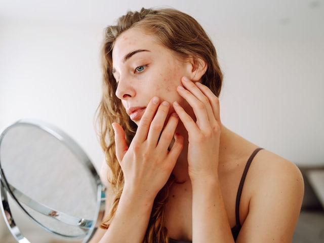 गर्मियों में किस वजह से फटने लगती है स्किन? किस तरह कर सकते हैं बचाव