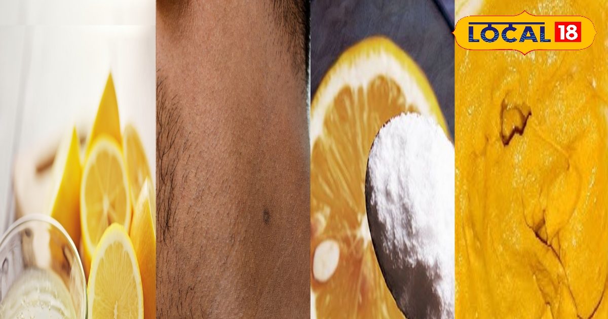 बस 10 मिनट में साफ और गोरी गर्दन! घर पर मौजूद चीजों से हटाएं जिद्दी कालापन