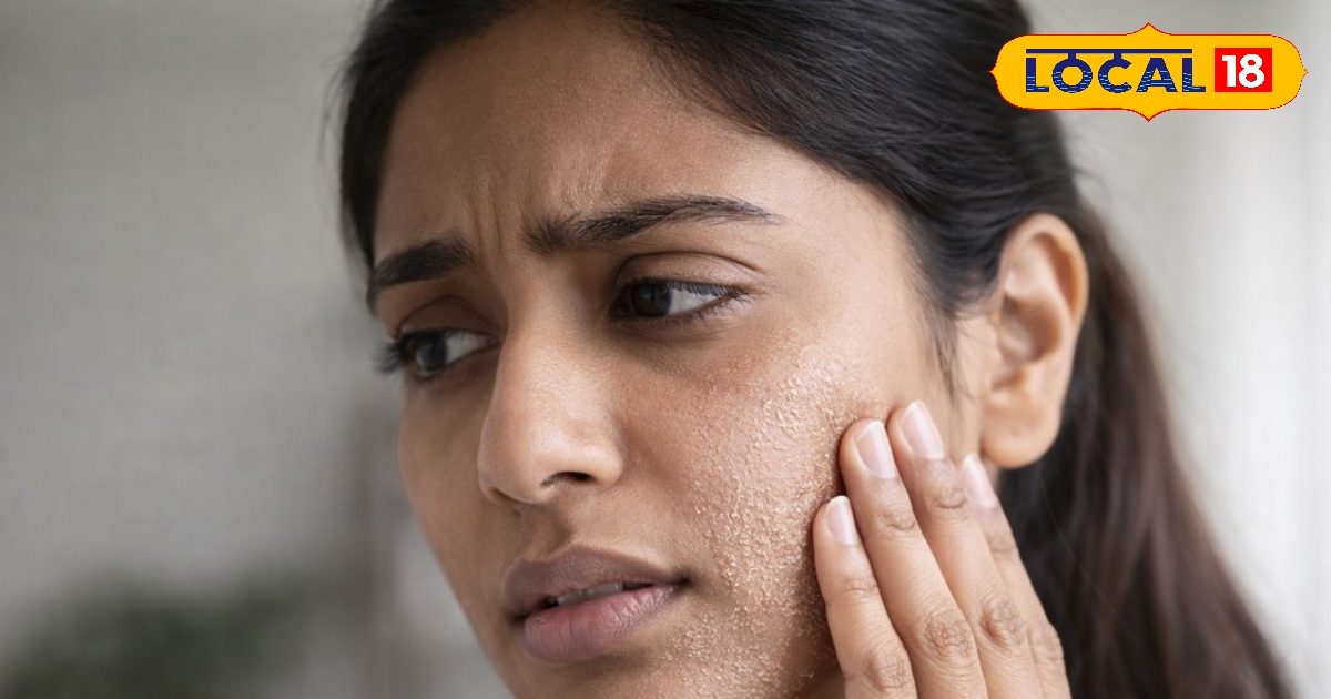 Summer Skin Care: गर्मियों में झुलस रही है स्किन? अपनाएं डॉक्टर के ये 5 अचूक उपाय, दिखेगा जादुई असर