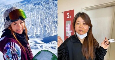 एक्सीडेंट के बाद हुई सर्जरी ने किकी को तोड़ दिया, लेकिन उन्होंने दोबारा अपनी जिंदगी जीने का फैसला किया.