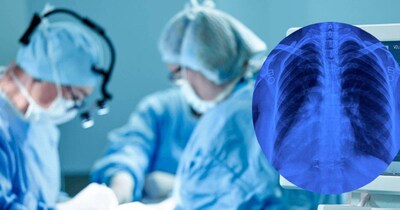 आरएमएल अस्‍पताल में सीटीवीएस के डॉक्‍टर नरेंद्र झाझर‍िया की टीम ने की हार्ट ड‍िजीज की ग्‍लोबल फर्स्‍ट सर्जरी. 