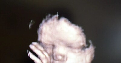 गर्भ में ही हो जाते हैं महिला के पूरे जीवनकाल में मौजूद अंडे का निर्माण (इमेज- फाइल फोटो)  