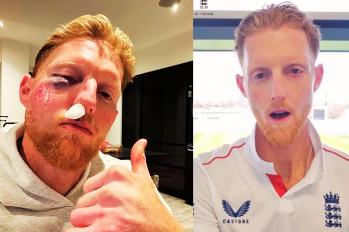 VIDEO: सर्जरी के बाद बेन स्टोक्स का चेहरा पूरी तरह से बदला, पहली नजर में देखने पर लगेगा झटका