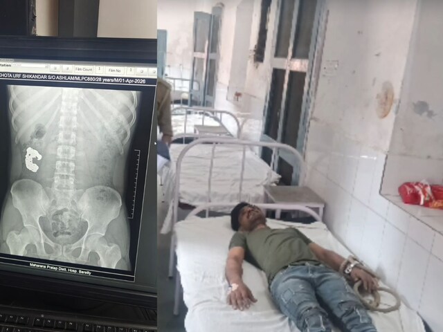 ब्रेसलेट खा गया चोर, फिर उसके साथ बाथरूम जाने लगी पुलिस, मल के रास्ते...