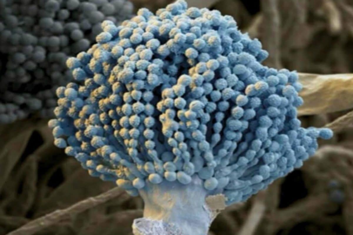 इंसान के फेंफड़ों में पैदा हो रहा ये 'खूबसूरत' फंगस, अंदर से खा रहा शरीर, लोगों में तेजी से फैल रही है बीमारी!