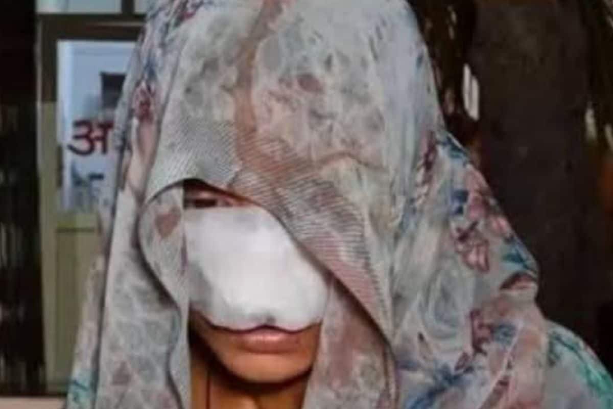 हैवान बना पति, नाक काटकर किया अलग, गाल पर लगे 10 टांके, पहले पीटकर किया अधमरा