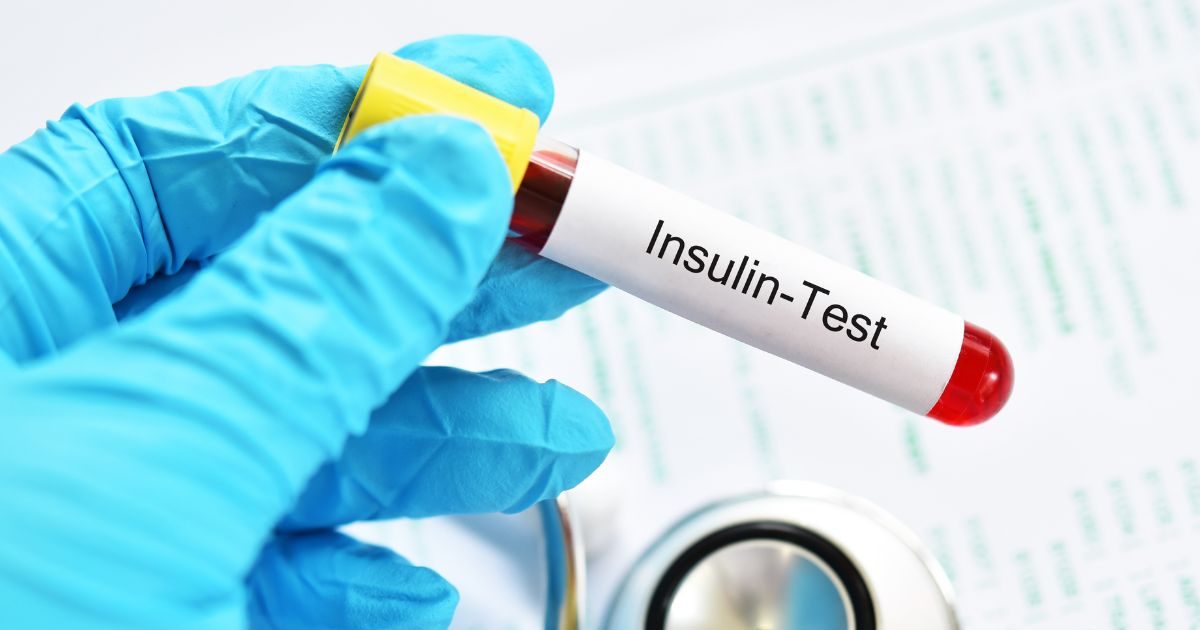 आपके शरीर में इंसुलिन रेजिस्टेंस है या नहीं? इसका पता लगाने के लिए कौन सा टेस्ट कराएं