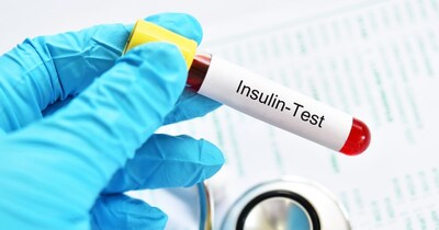HOMA-IR टेस्ट के जरिए इंसुलिन रेजिस्टेंस का पता लगाया जा सकता है.