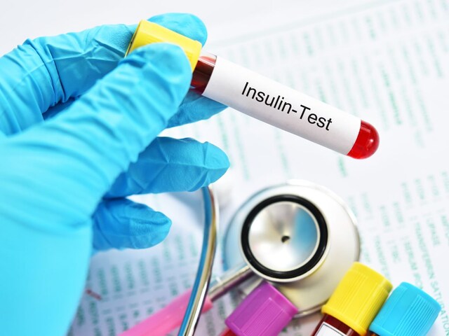 आपके शरीर में इंसुलिन रेजिस्टेंस है या नहीं? इसके लिए कौन सा टेस्ट कराएं