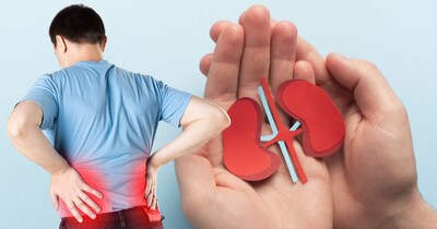 किडनी स्टोन का खतरा पुरुषों को थोड़ा ज्यादा होता है, लेकिन महिलाएं भी इसका शिकार हो जाती हैं.