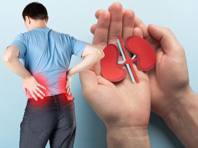 किडनी स्टोन का खतरा महिलाओं को ज्यादा होता है या पुरुषों को? डॉक्टर से जानिए
