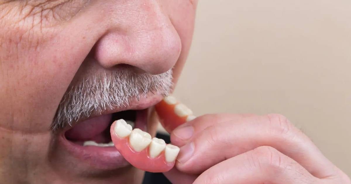 मरीज निगल गया अपने ही नकली दांत, फूड पाइप में फंसे, गंगाराम के डॉक्टरों ने निकाले