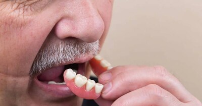 गंगाराम अस्‍पताल में आया एक मरीज अपने नकली दांतों की प्‍लेट न‍िगल गया था ज‍िसे डॉक्‍टरों ने ब‍िना सर्जरी के न‍िकाला. 