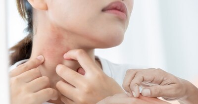 गर्मी की वजह से त्वचा से जुड़ी समस्याएं.