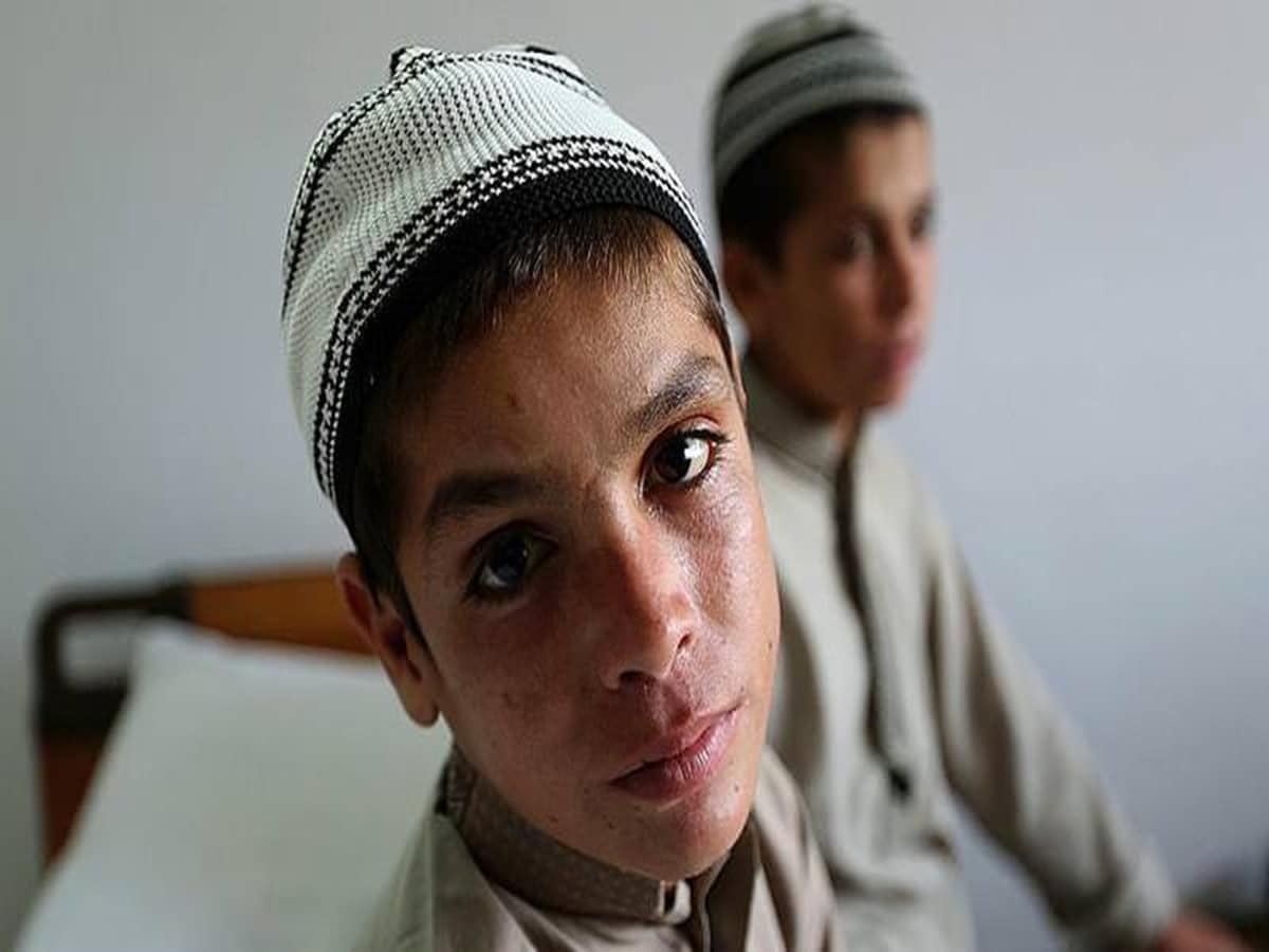 हर रात 'मर' जाते हैं ये भाई, बर्फ-सा ठंडा पड़ जाता है शरीर, अगली सुबह फिर हो जाते हैं जिंदा!