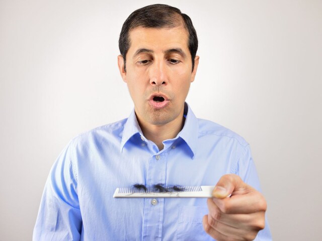 क्या वेट लॉस की दवा ओजेम्पिक लेने से हो सकते हैं गंजे? नई स्टडी में हुआ खुलासा