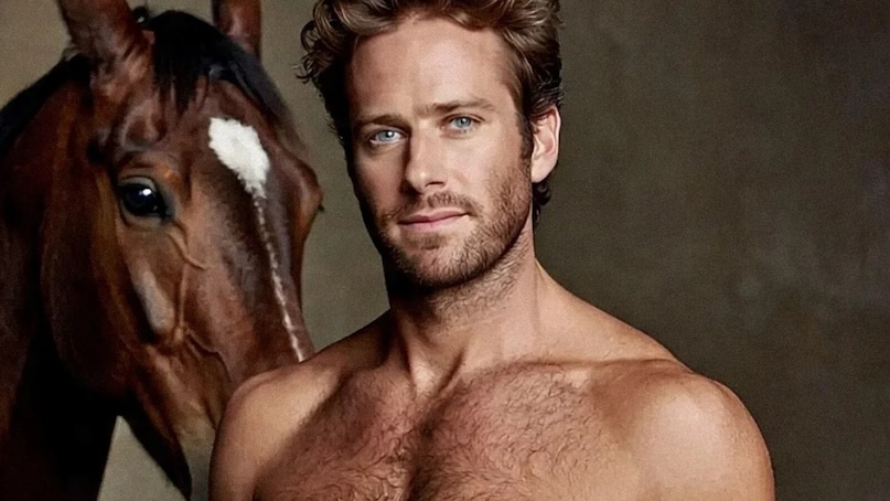 Armie Hammer 