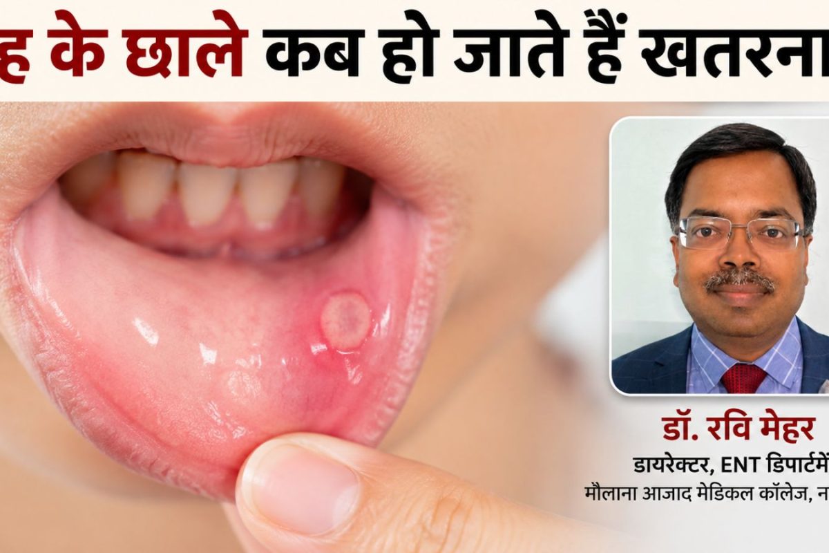 मुंह के छाले कब ले लेता है कैंसर का रूप, कैसे समझें कि ये नॉर्मल नहीं, ENT के बड़े डॉक्टर ने बताया क्लू