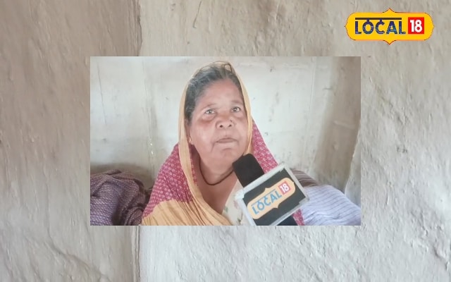 Prickly Heat Remedy: महंगे पाउडर छोड़ें! गर्मी में घमौरी का काल है यह देसी नुस्खा, मिलेगी बर्फ जैसी ठंडक