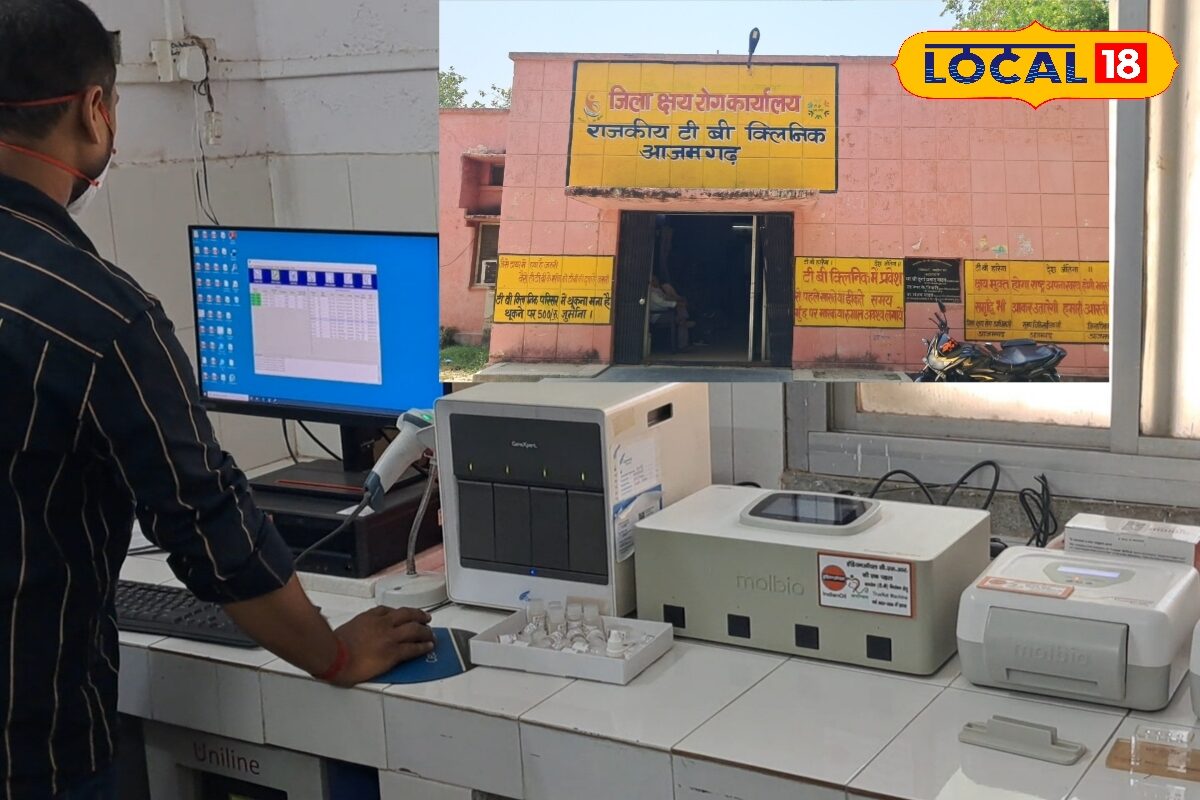 घर बैठे एआई से होगा एक्स-रे, अस्पताल में लाइन लगाने की झंझट होगी खत्म, आजमगढ़ में शुरू हुआ मेडिकल मोबाइल यूनिट