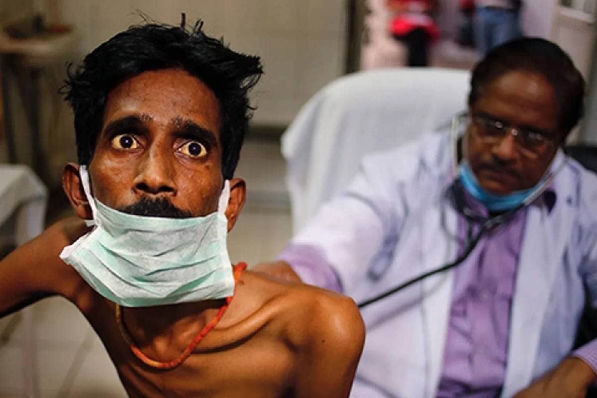 दिल्ली में टीबी विस्फोट! डेढ़ महीने में मिले 12 हजार मरीज, अभी और कितने?