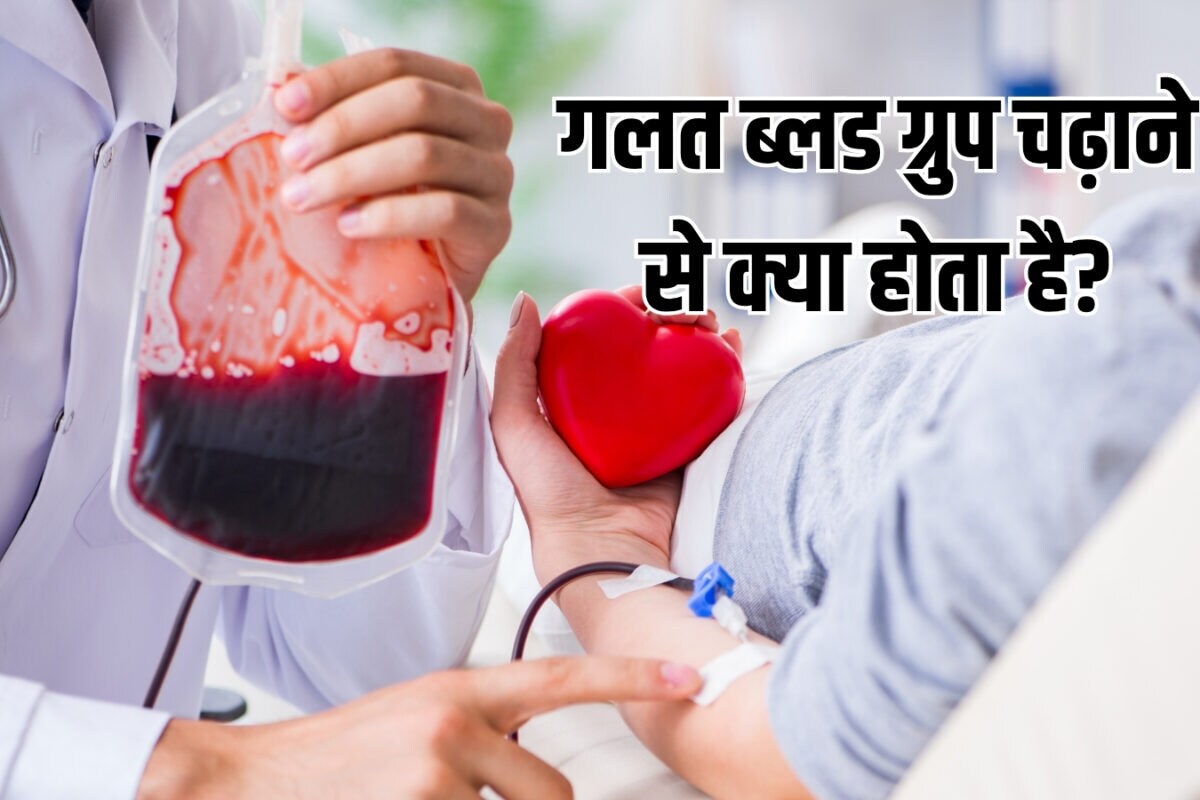 गलत ब्लड ग्रुप चढ़ाने से क्या होता है? O+ की जगह अगर B+ ब्लड चढ़ा दें तो क्या नुकसान हो सकते हैं, डॉ. से जानें