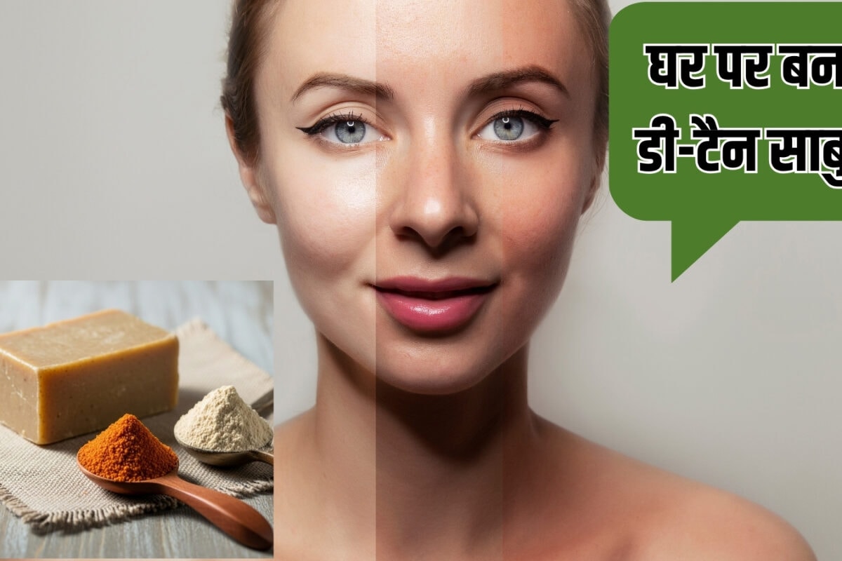 टैनिंग हटाने का नेचुरल तरीका, मसूर दाल से बनाएं डी-टैन साबुन, धूप से झुलसी चमड़ी होने लगेगी गोरी