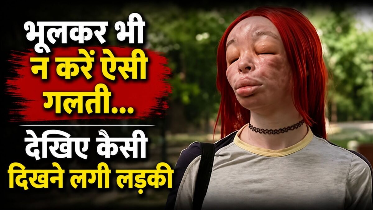 खूबसूरती की चाह में चेहरे पर रोज लगाती थी सिलिकॉन इंजेक्शन..?