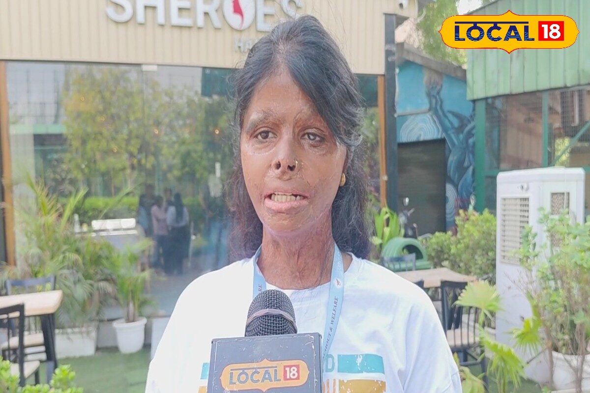 समाज में सम्मान से जी सकेंगे... योगी सरकार के फैसले पर एसिड अटैक पीड़िता क्या कह रहीं? पढ़ें